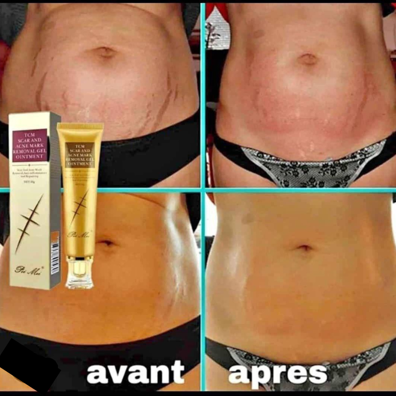 Gel Réparateur TCM SCAR – Effacez vos cicatrices et vergetures, naturellement 🇧🇯