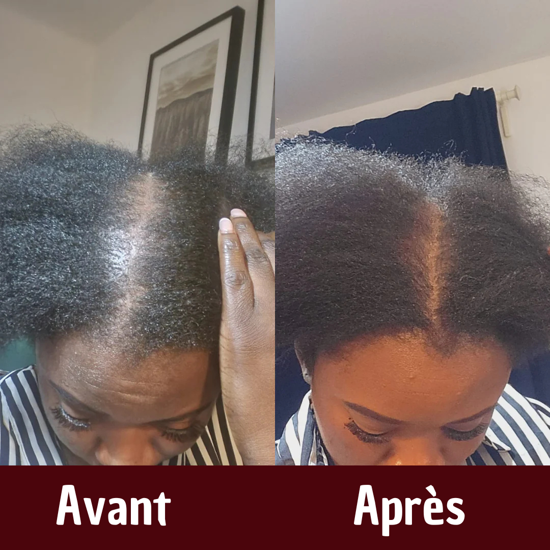 Huile de Batana Brute 100 % Pure 🇧🇯