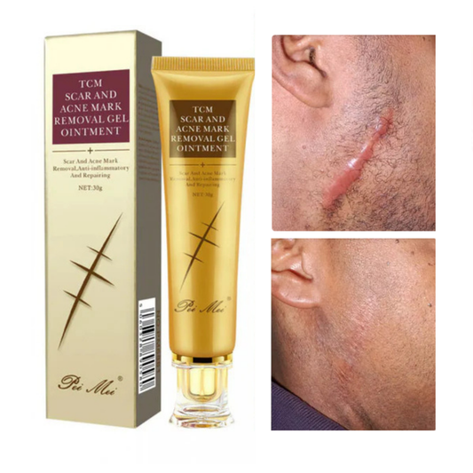 Gel Réparateur TCM SCAR – Effacez vos cicatrices et vergetures, naturellement 🇧🇯